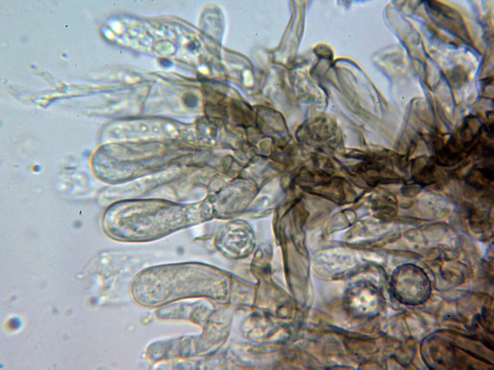 Microscopía de Tomentella asperula - 10 - Basidios KOH